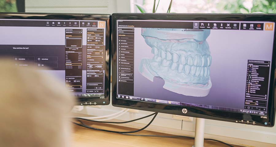 Analyse der Kiefergelenke am Computer